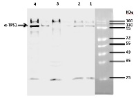 TPS1 | Trehalose-6-phosphate synthase 1 in the group Antibodies Plant/Algal  / Developmental Biology / Signal transduction at Agrisera AB (Antibodies for research) (AS12 2635)